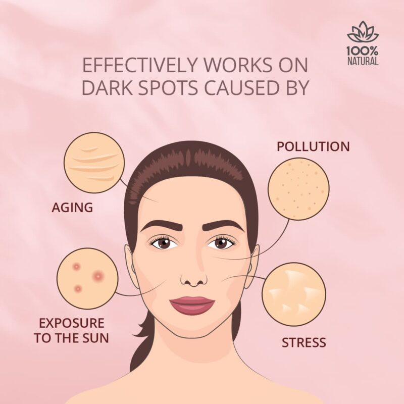 Anti pigmentation cream-Teachers' Grace