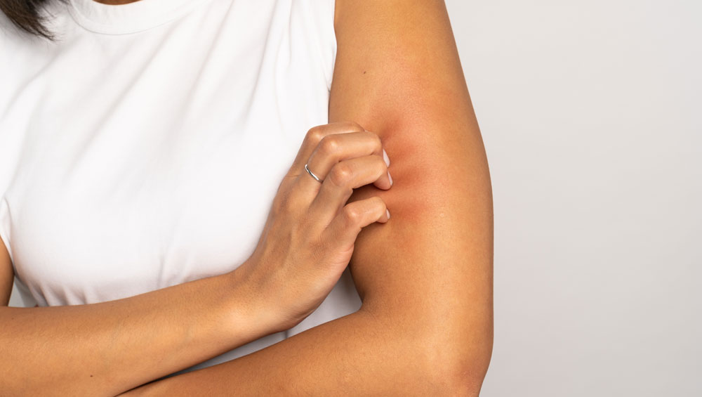 Skin Infections Treatment