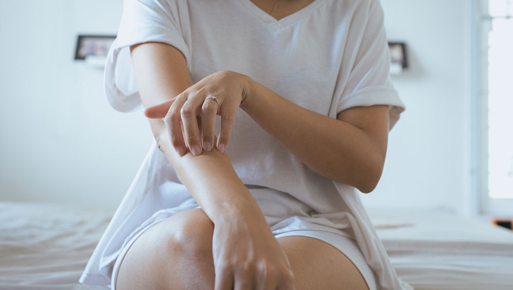 itchy skin treatment